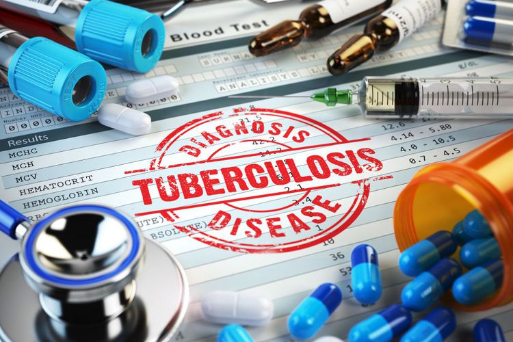 Tuberkulosis, TBC
